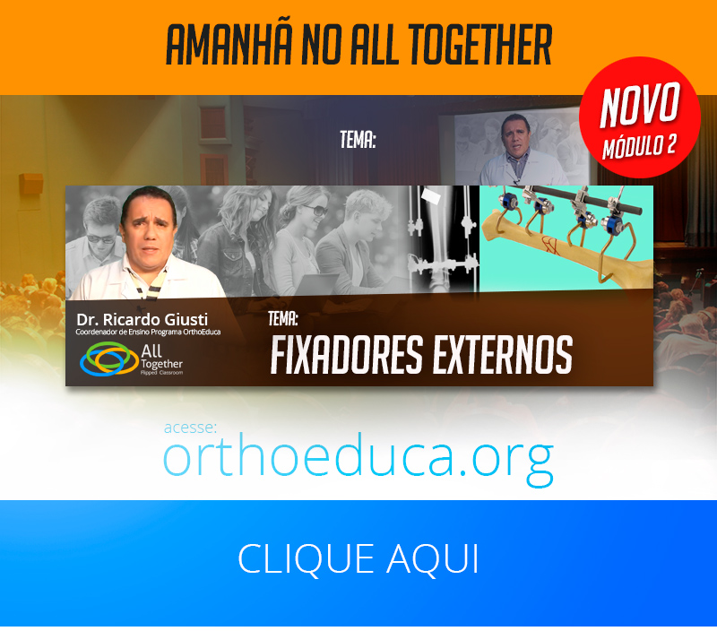 Fixadores Externos - Amanh no All Together