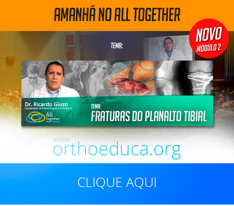 Fraturas do Planalto Tibial - Amanhã no All Together Fraturas do Planalto Tibial - Amanhã no All Together