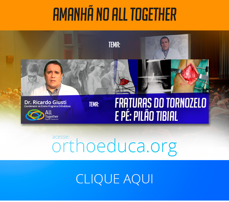 Fraturas do Tornozelo e Pé: Pilão Tibial - Amanhã no All Together Fraturas do Tornozelo e Pé: Pilão Tibial - Amanhã no All Together