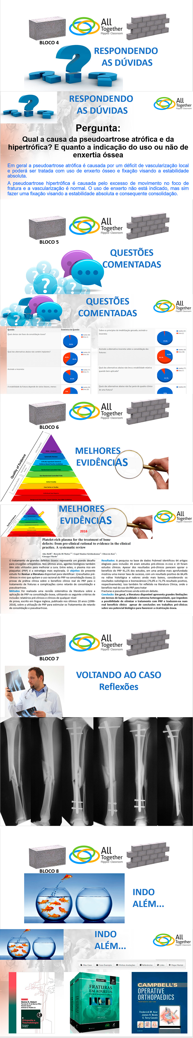 Princpios das fraturas fechadas - Aula do All together j est disponvel para visualizao ondemand