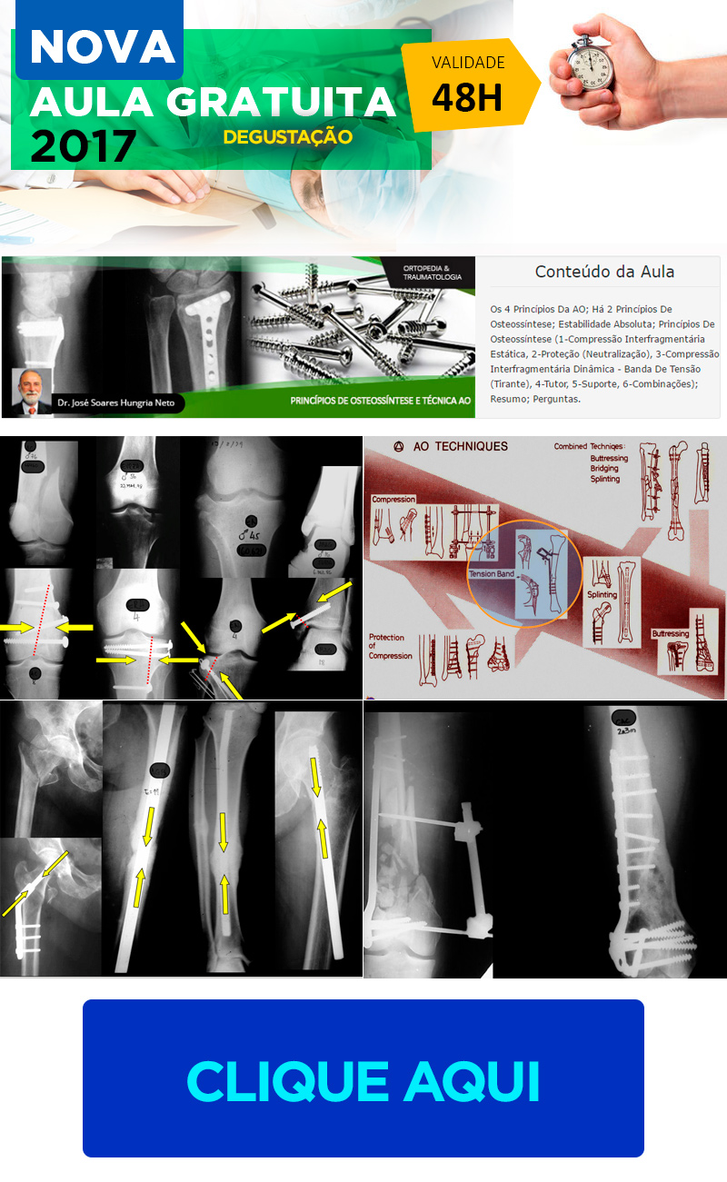 Princpios de Osteossntese e Tcnica AO (aula degustao grtis)