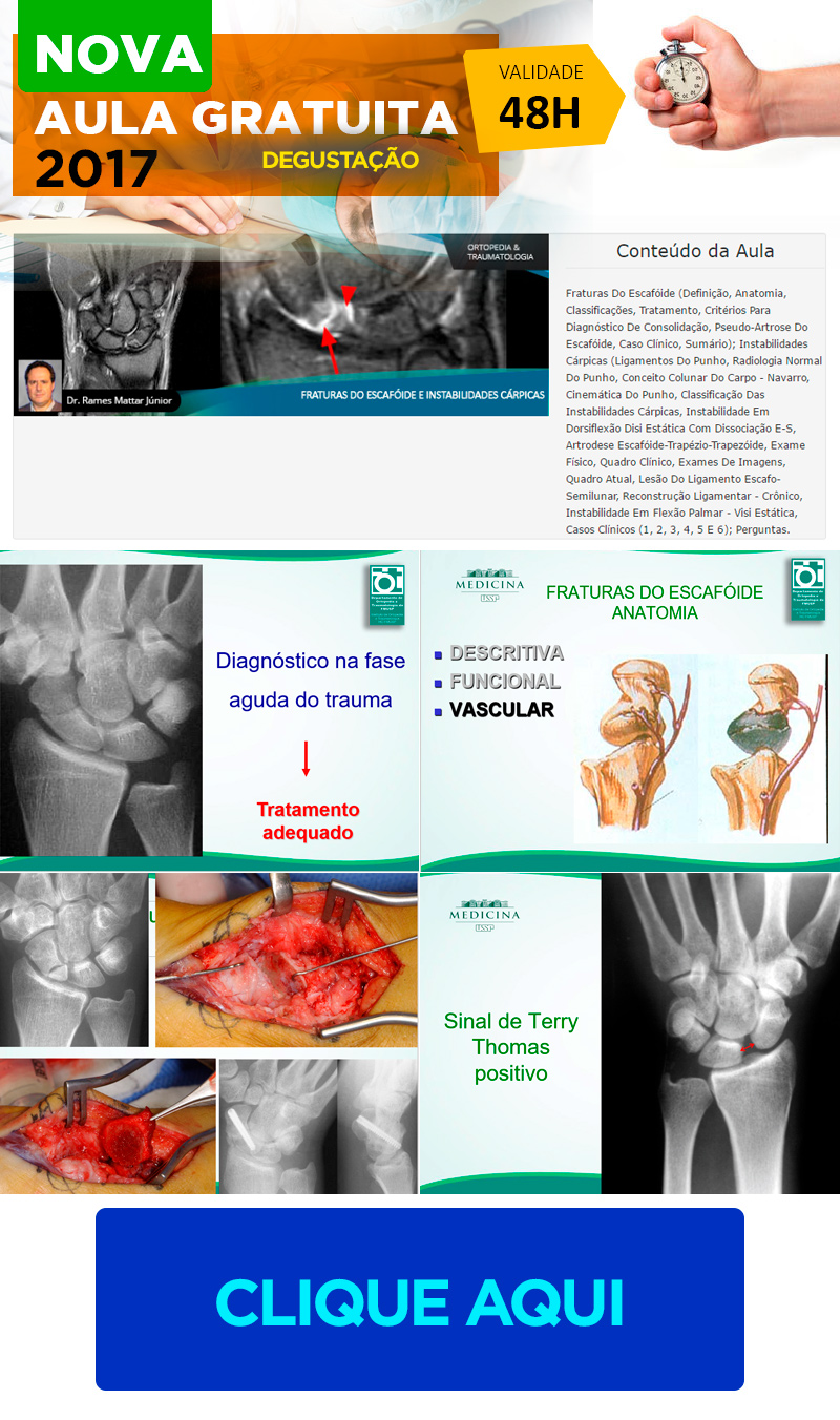Fraturas do Escafoide e Instabilidades Crpicas (aula degustao grtis)