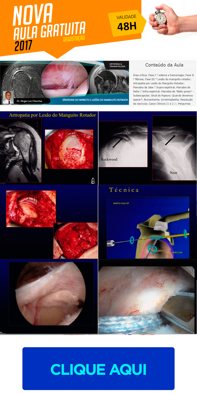 Sndrome do Impacto e Leses do Manguito Rotador (aula degustao grtis)