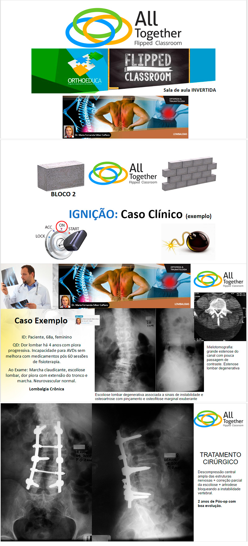 Lombalgias - Caso clínico de hoje no All Together às 14h Participe! Lombalgias - Caso clínico de hoje no All Together às 14h Participe!
