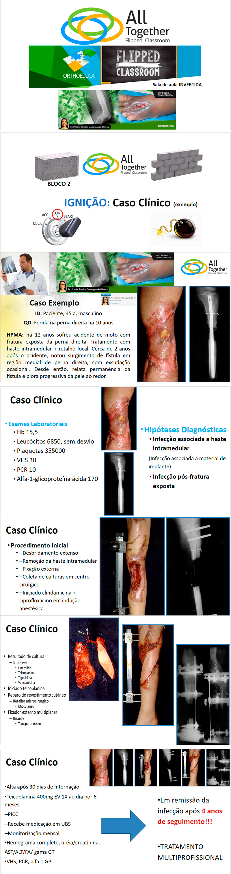 Osteomielites - Caso clínico de hoje no All Together às 12h Participe! Osteomielites - Caso clínico de hoje no All Together às 12h Participe!