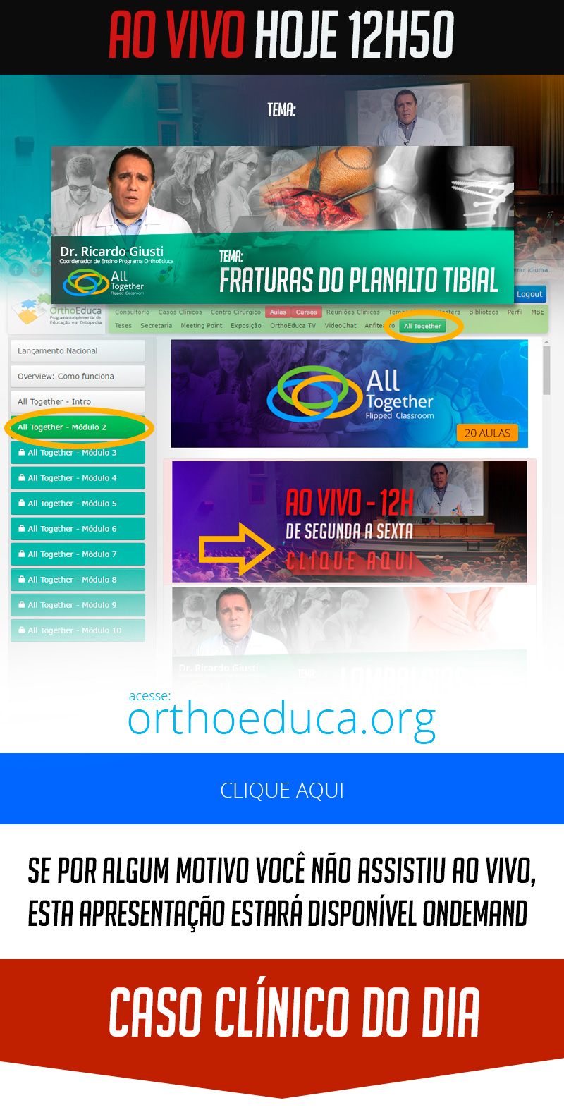 Fraturas do Planalto Tibial - Caso clínico de hoje no All Together às 12h50 - Participe! Fraturas do Planalto Tibial - Caso clínico de hoje no All Together às 12h50 - Participe!