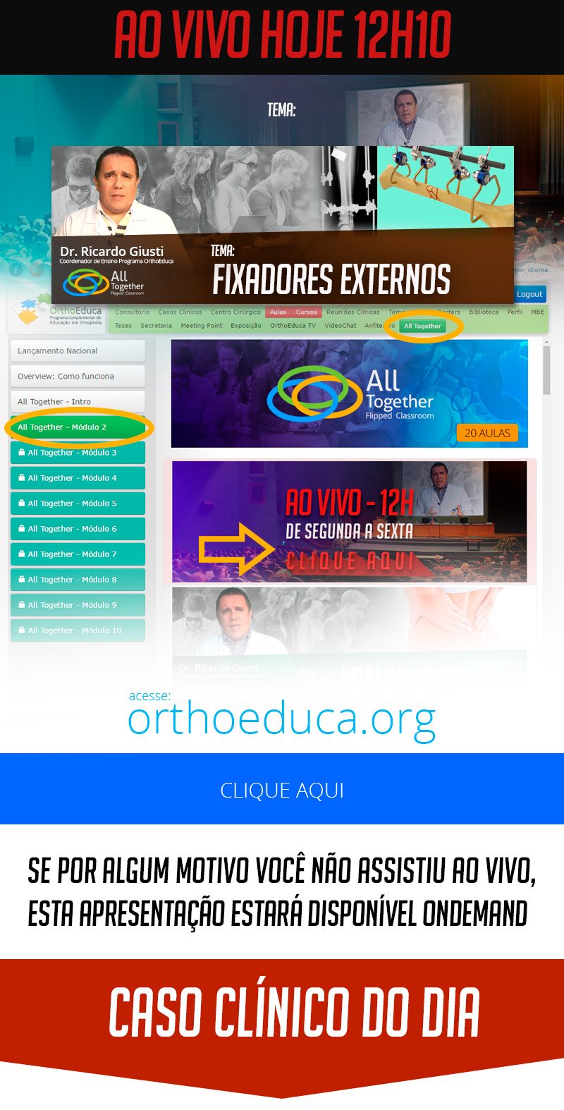 Fixadores Externos - Caso clínico de hoje no All Together às 12h10 Fixadores Externos - Caso clínico de hoje no All Together às 12h10