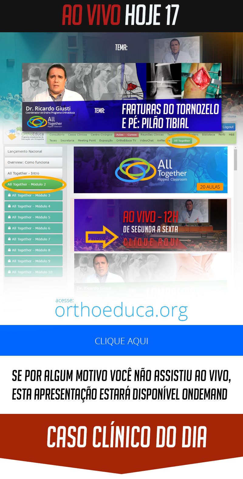 Fraturas do Tornozelo e Pé: Pilão Tibial - Caso clínico de hoje no All Together às 17h Fraturas do Tornozelo e Pé: Pilão Tibial - Caso clínico de hoje no All Together às 17h