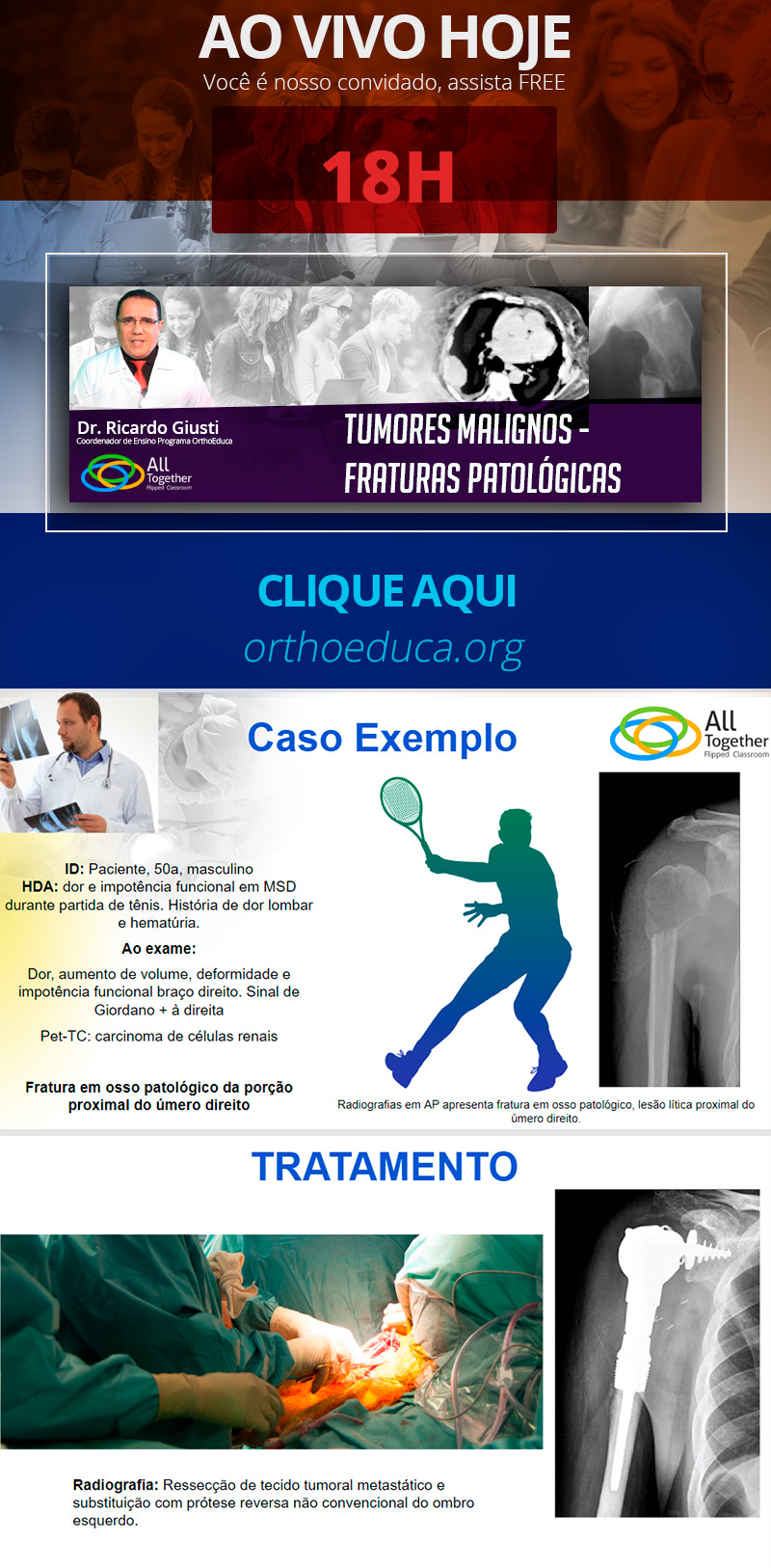 Tumores Malignos - Fraturas Patolgicas - Daqui a pouco 18H AO VIVO!