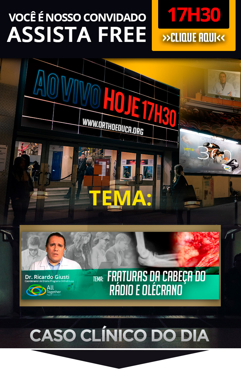 Fraturas da Cabeça do Rádio e Olécrano - Daqui a pouco as 17h30min ao vivo no All Together - Assista FREE! Fraturas da Cabeça do Rádio e Olécrano - Daqui a pouco as 17h30min ao vivo no All Together - Assista FREE!