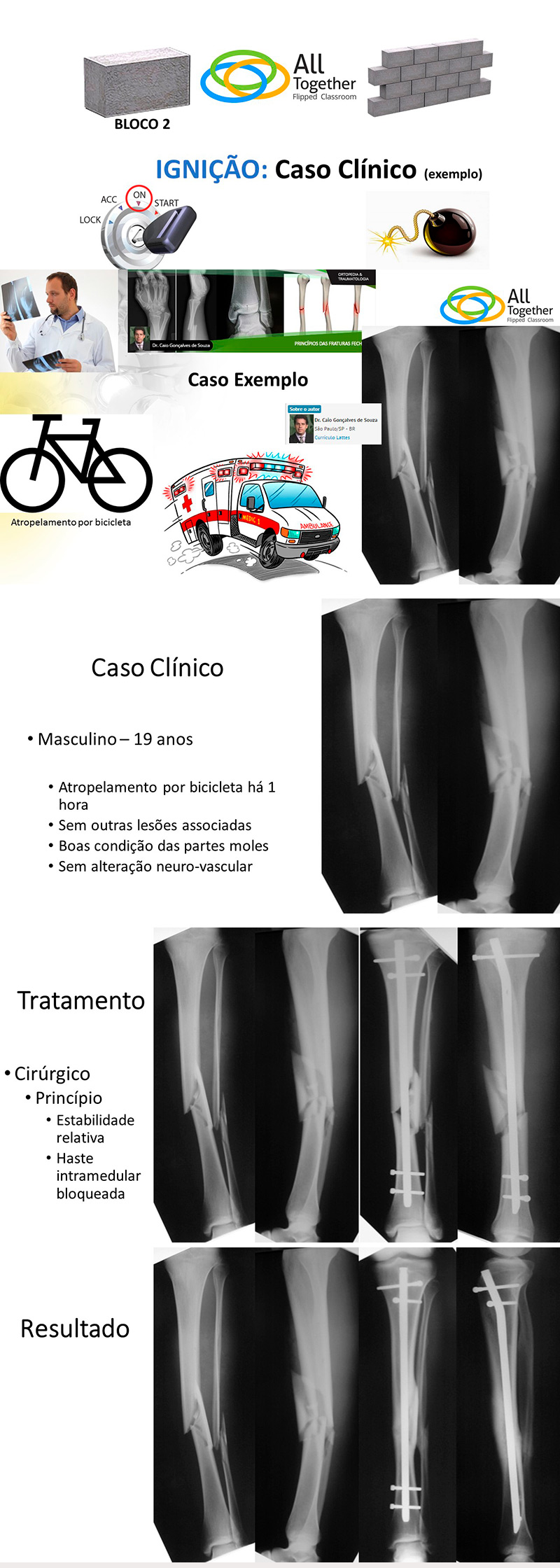 Princípios das fraturas fechadas - Caso clínico de hoje no All Together às 12h Participe! Princípios das fraturas fechadas - Caso clínico de hoje no All Together às 12h Participe!