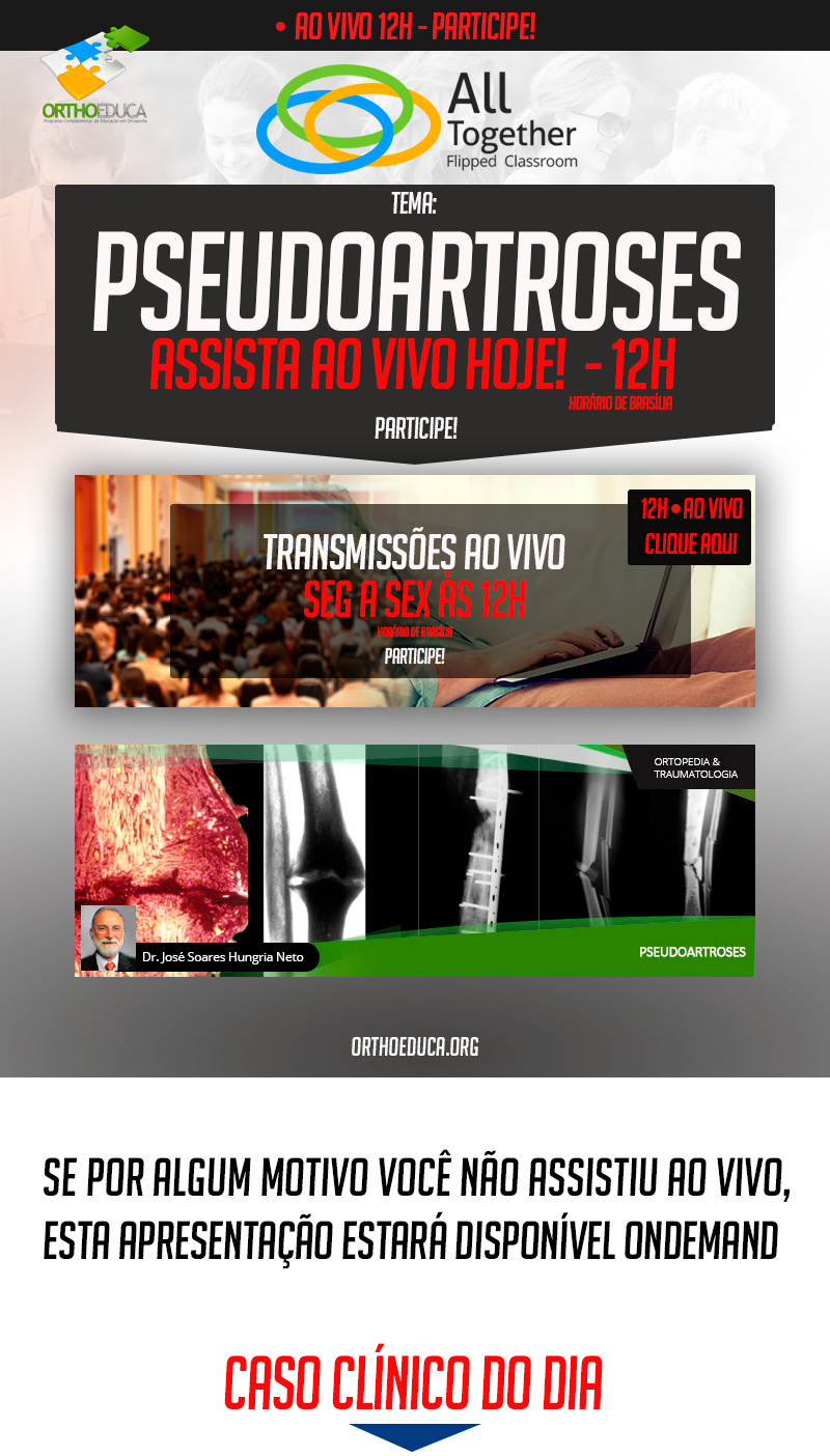 Pseudoartroses - Caso clínico de hoje no All Together às 12h Participe! Pseudoartroses - Caso clínico de hoje no All Together às 12h Participe!