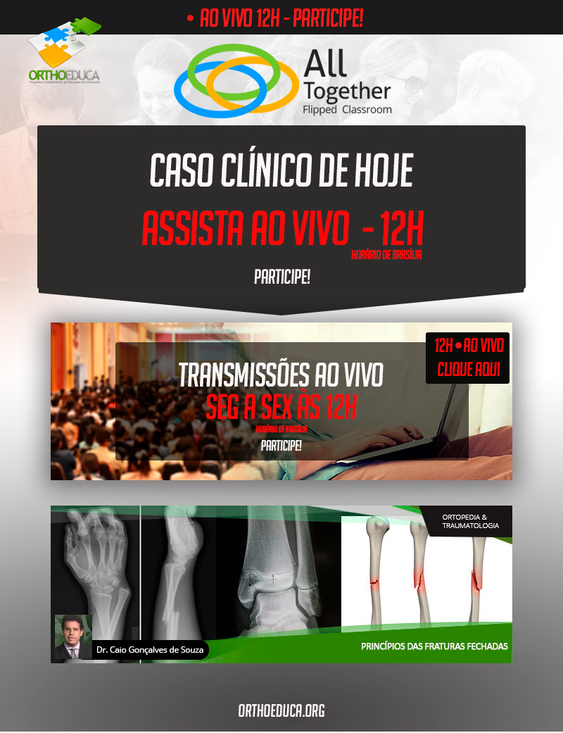 Princípios das fraturas fechadas - Caso clínico de hoje no All Together às 12h Participe! Princípios das fraturas fechadas - Caso clínico de hoje no All Together às 12h Participe!