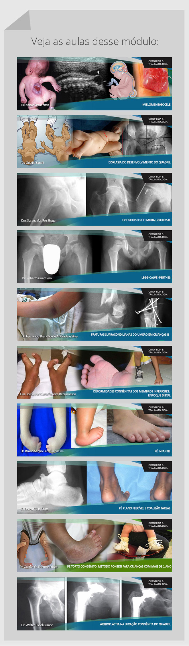 Ortopedia Peditrica: Cursos Online OrthoEduca