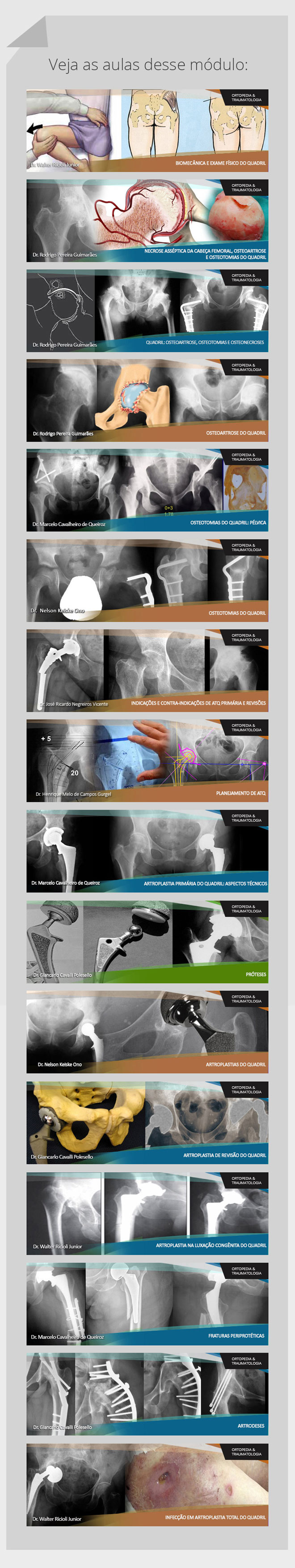 Quadril: Cursos Online OrthoEduca