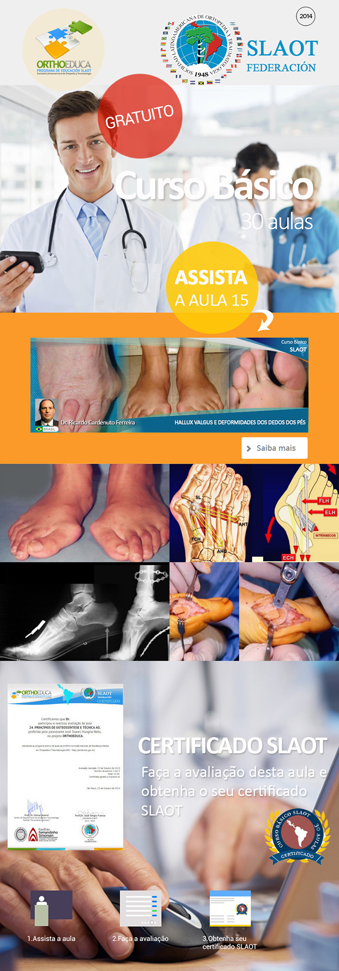 Assista a aula 16: Hallux Valgus e Deformidades dos Dedos dos Ps