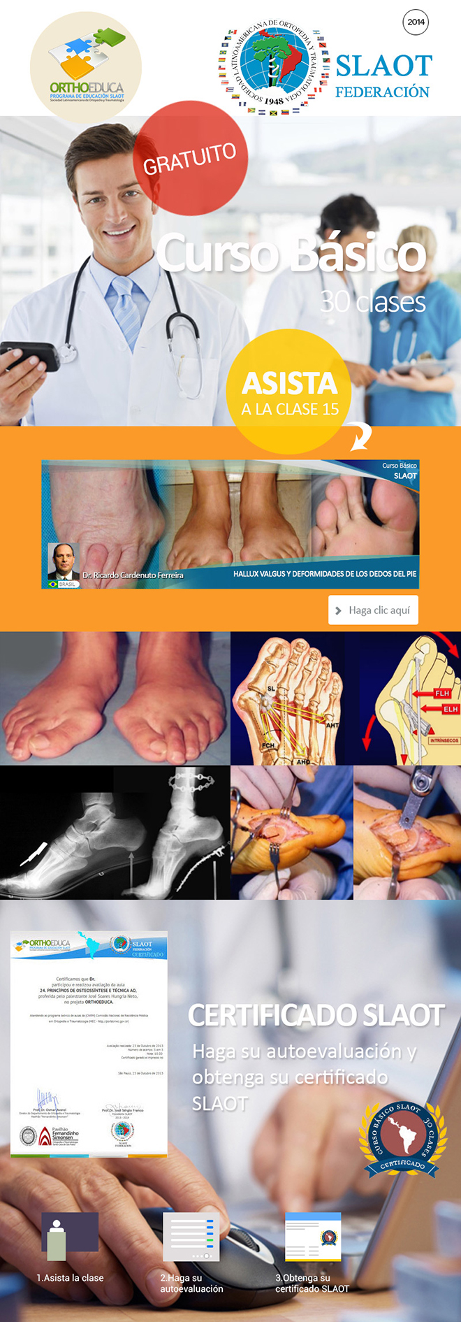 Asista a La Clase 16: Hallux Valgus y Deformidades de los Dedos del Pie