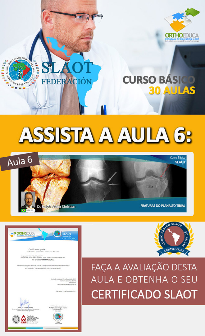 Assista a aula 6: Fraturas do Planalto Tibial