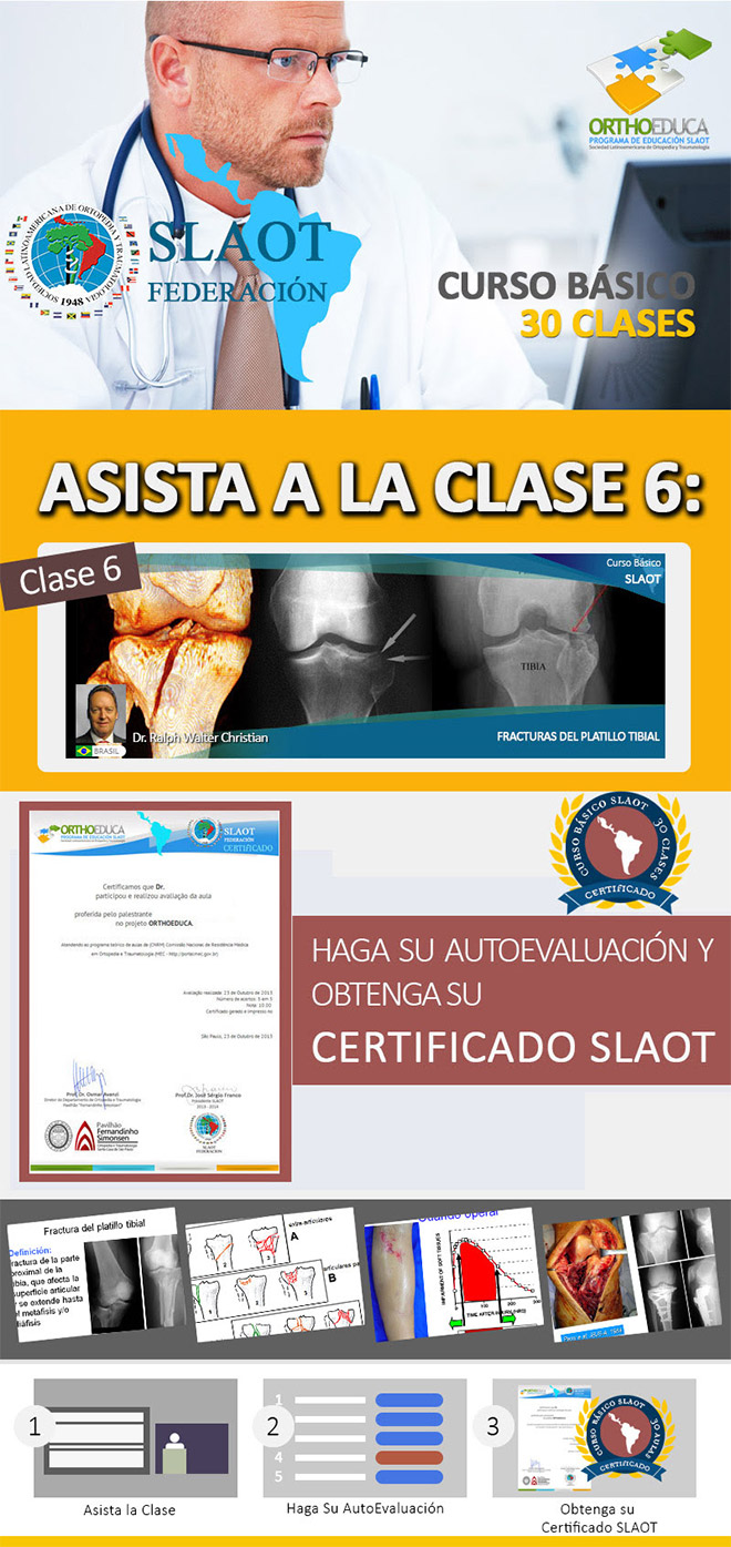 Asista a La Clase 6: Fracturas Del Platillo Tibial