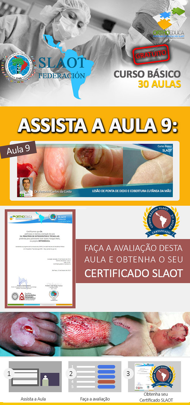 Assista a aula 9: Leso de Ponta de Dedo e Cobertura Cutnea da Mo