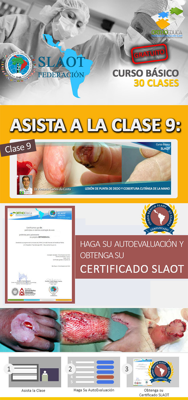 Asista a La Clase 9: Lesin De Punta De Dedo Y Cobertura Cutnea De La Mano