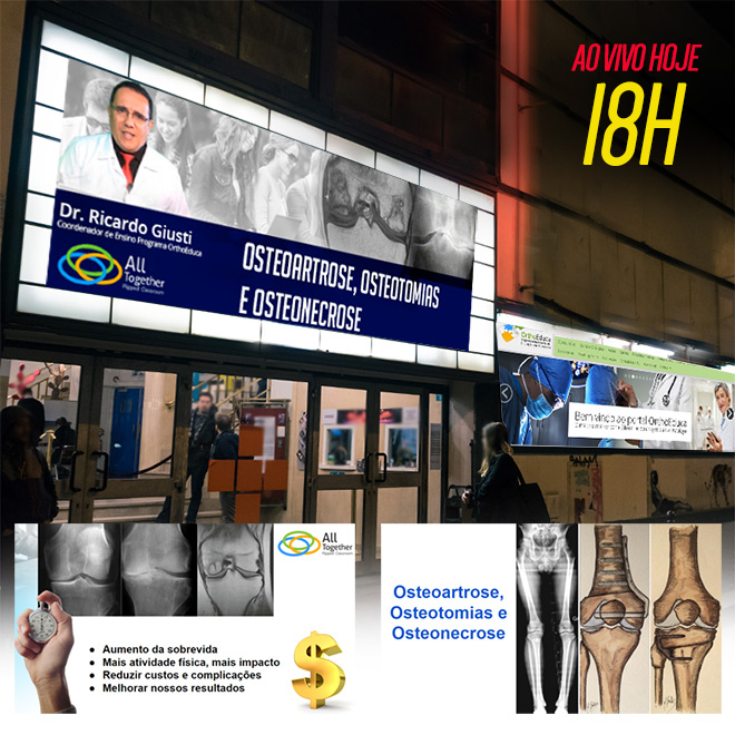 Osteoartrose, Osteotomias e Osteonecrose - AO VIVO 18h - Participe!