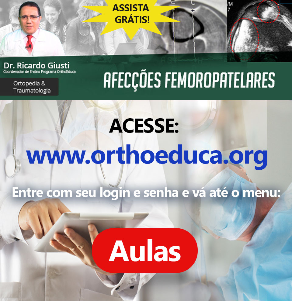 Afeces Femoropatelares: OrthoEduca convida: Vamos estudar juntos?