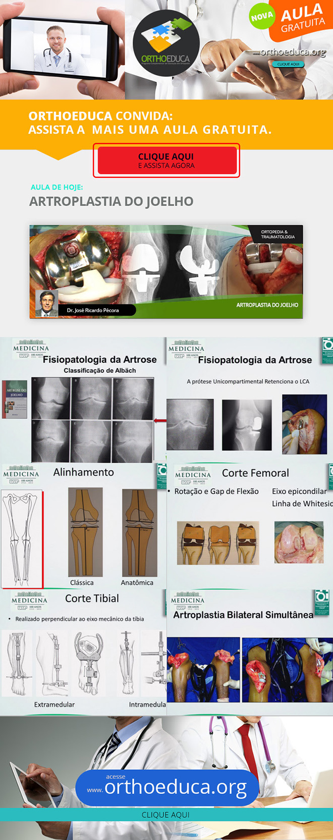 OrthoEduca Convida - Assista Hoje GRTIS: Artroplastia do Joelho