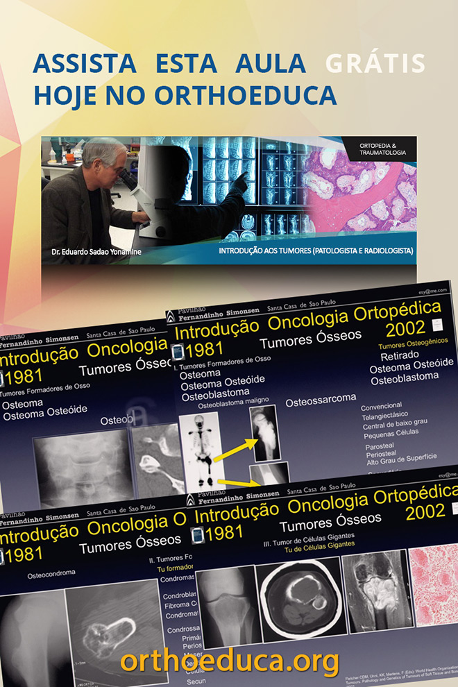 OrthoEduca Convida - Assista Hoje GRTIS: Introduo aos Tumores (Patologista e Radiologista)