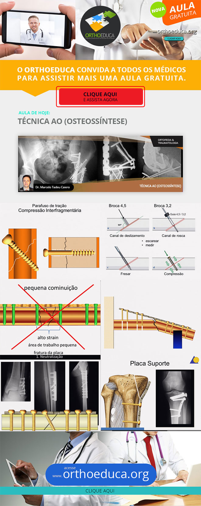 OrthoEduca Convida - Assista Hoje GRTIS: Tcnica AO (Osteossntese)