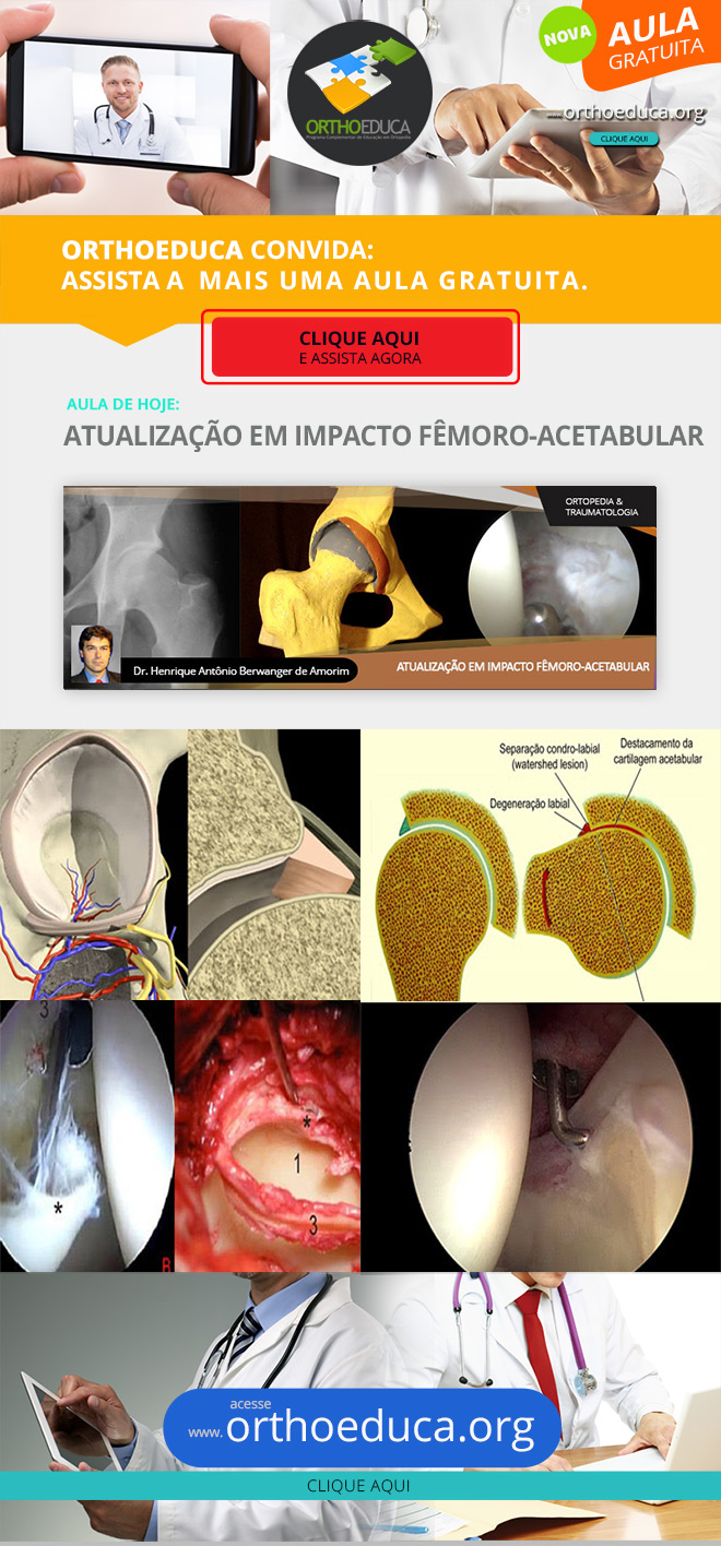 OrthoEduca Convida - Assista Hoje GRTIS: Atualizao em Impacto Fmoro-Acetabular