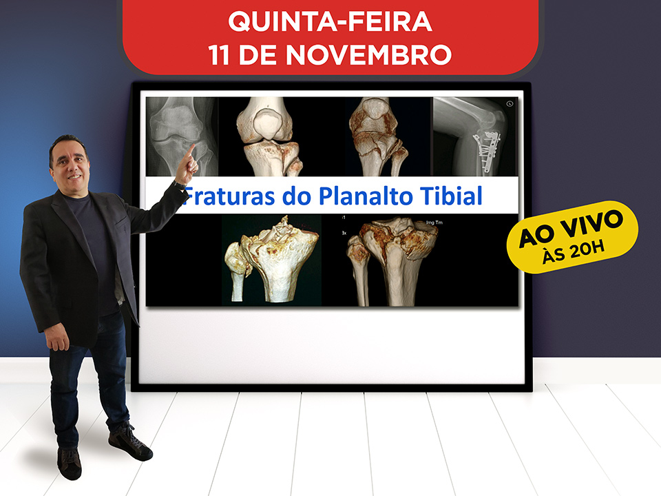 Fraturas do Planalto Tibial - Hoje ao vivo s 19h, Participe!