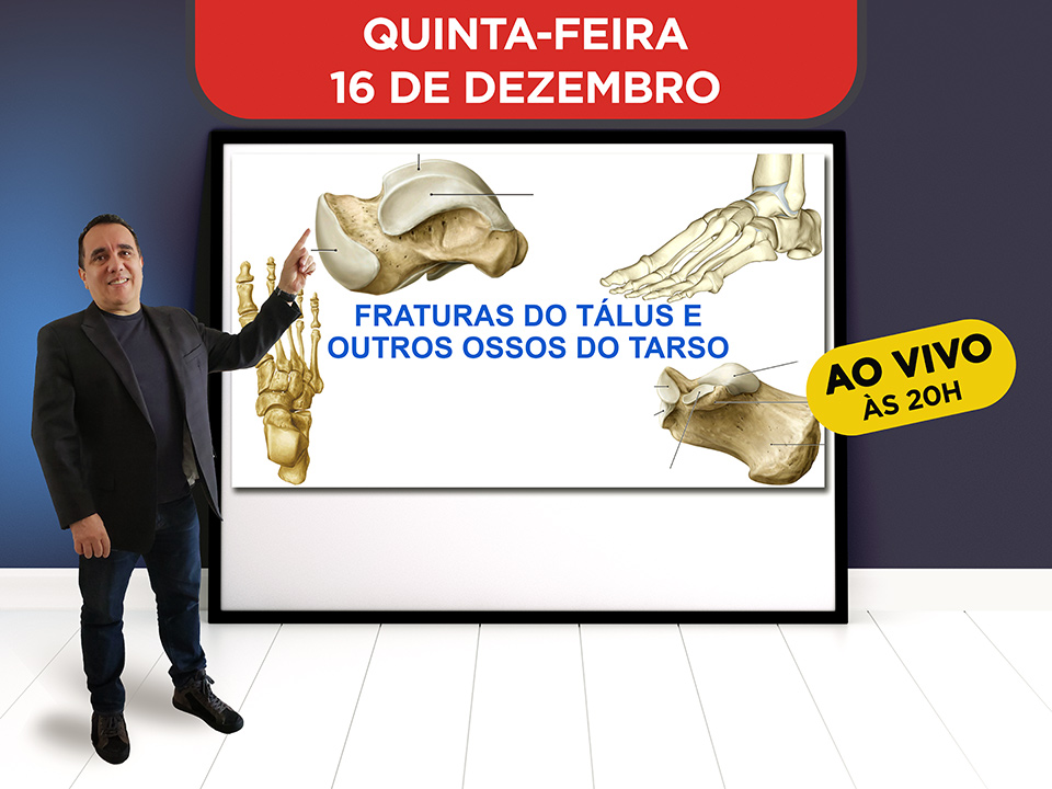 Fraturas do Tlus e Outros Ossos do Tarso - Hoje ao vivo s 20h, Participe!