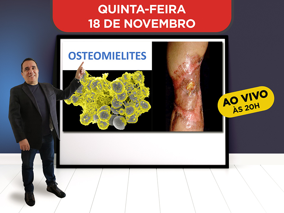 Osteomielites - Hoje ao vivo s 20h, Participe!