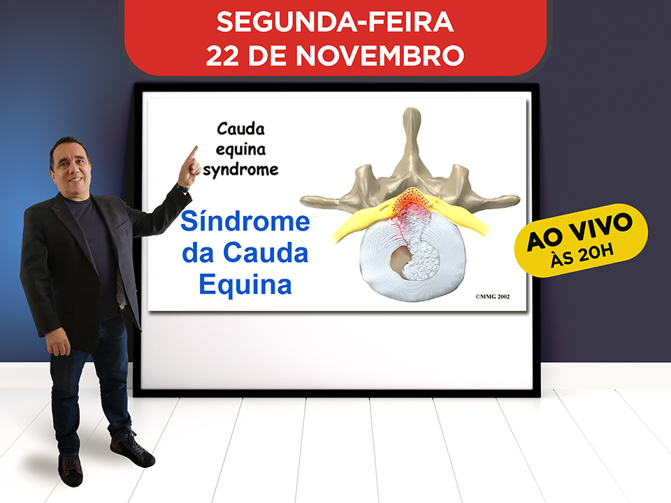 Sndrome da Cauda Equina - Hoje ao vivo s 20h, Participe!