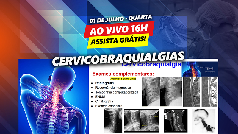 Cervicobraquialgias - Assista agora grtis no ondemand!