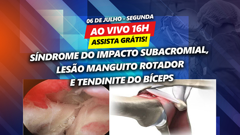 Sndrome do Impacto Subacromial, Leso Manguito Rotador e Tendinite do Bceps - Assista agora grtis no ondemand!