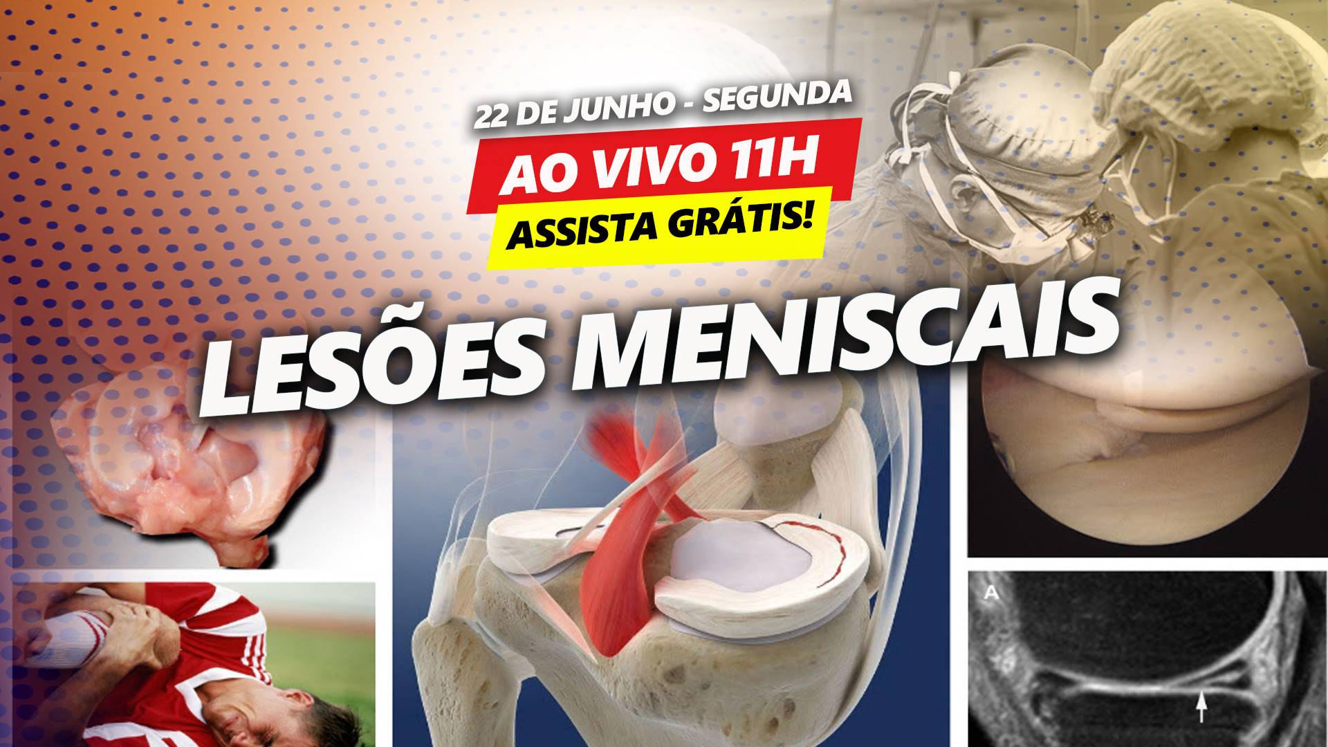 Leses Meniscais - Assista agora grtis no ondemand!