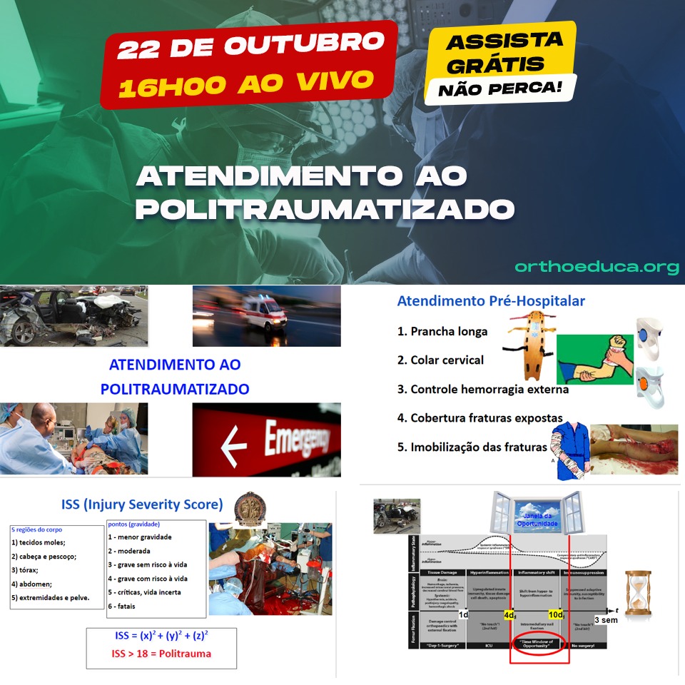 Teot aquecimento: Atendimento ao Politraumatizado ao vivo hoje s 16h