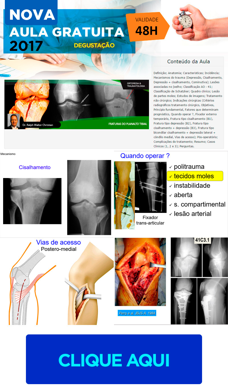 Fraturas do Planalto Tibial (Aula Degustao Grtis)