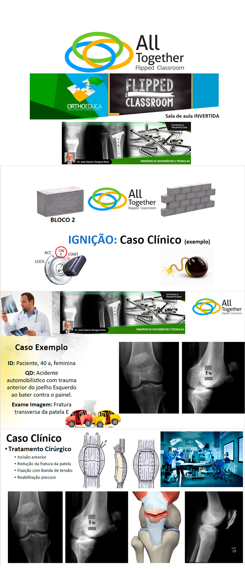 Princípios de Osteossíntese e Técnica AO - Caso clínico de hoje no All Together às 12h Participe! Princípios de Osteossíntese e Técnica AO - Caso clínico de hoje no All Together às 12h Participe!