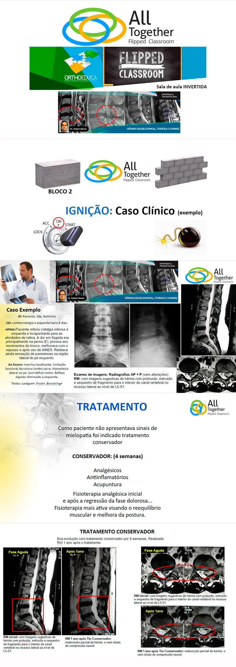 Hrnias Discais (Cervical, Torcica e Lombar) - Caso clnico de hoje no All Together s 12h Participe!