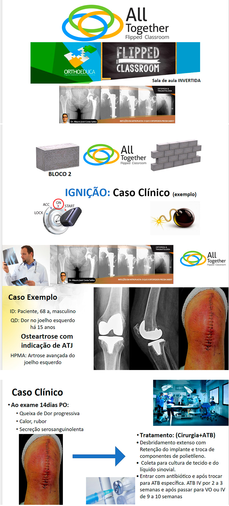 Infecções em artroplastia: O que o ortopedista precisa saber - Caso clínico de hoje no All Together às 12h Participe! Infecções em artroplastia: O que o ortopedista precisa saber - Caso clínico de hoje no All Together às 12h Participe!