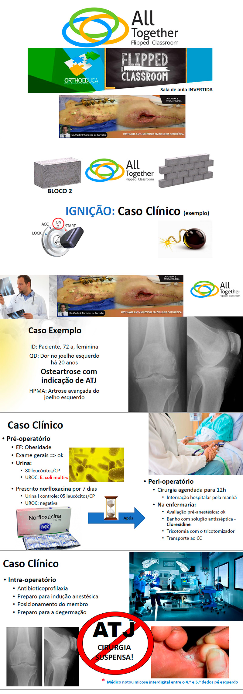 Profilaxia anti-infecciosa em cirurgia ortopédica - Caso clínico de hoje no All Together às 12h Participe Profilaxia anti-infecciosa em cirurgia ortopédica - Caso clínico de hoje no All Together às 12h Participe