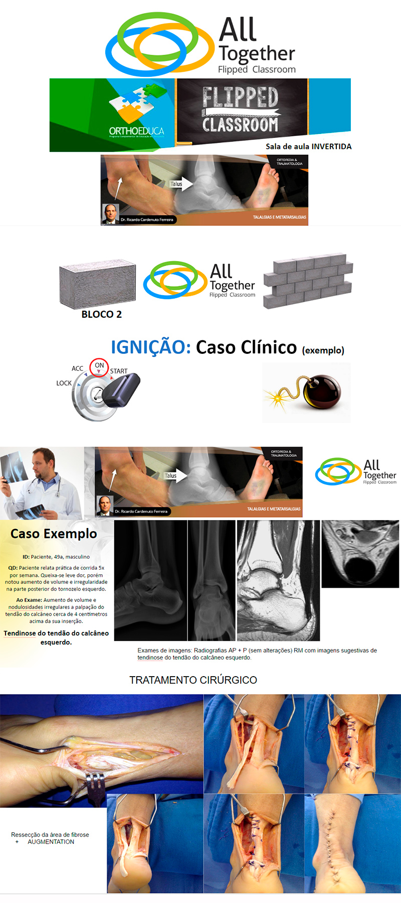 Talalgias - Caso clínico de hoje no All Together às 12h30 Participe! Talalgias - Caso clínico de hoje no All Together às 12h30 Participe!