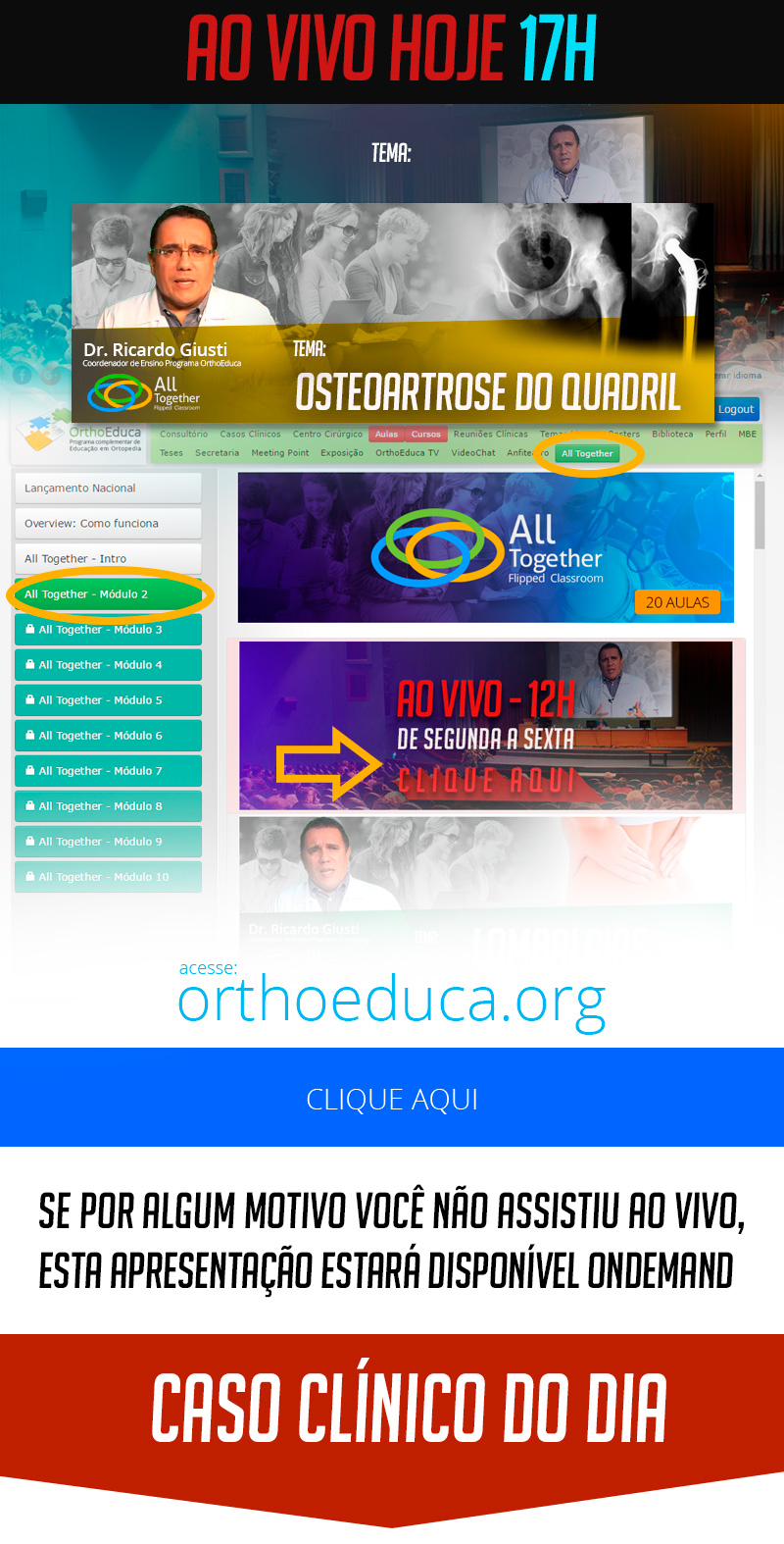 Osteoartrose do Quadril - Caso clínico de hoje no All Together às 17h Osteoartrose do Quadril - Caso clínico de hoje no All Together às 17h