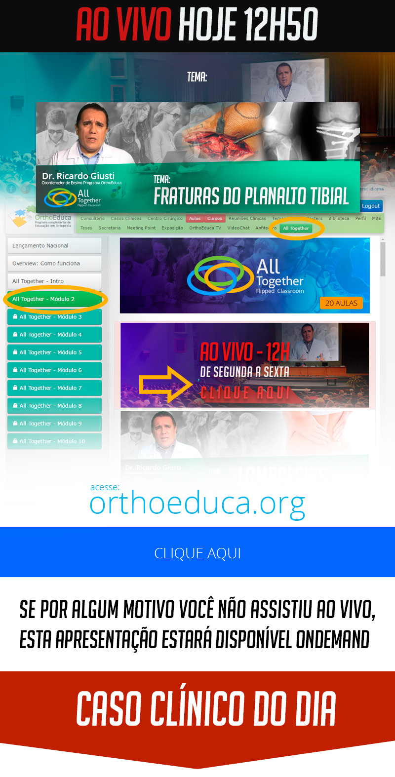 Fraturas do Planalto Tibial - Caso clínico de hoje no All Together às 12h50 - Participe!