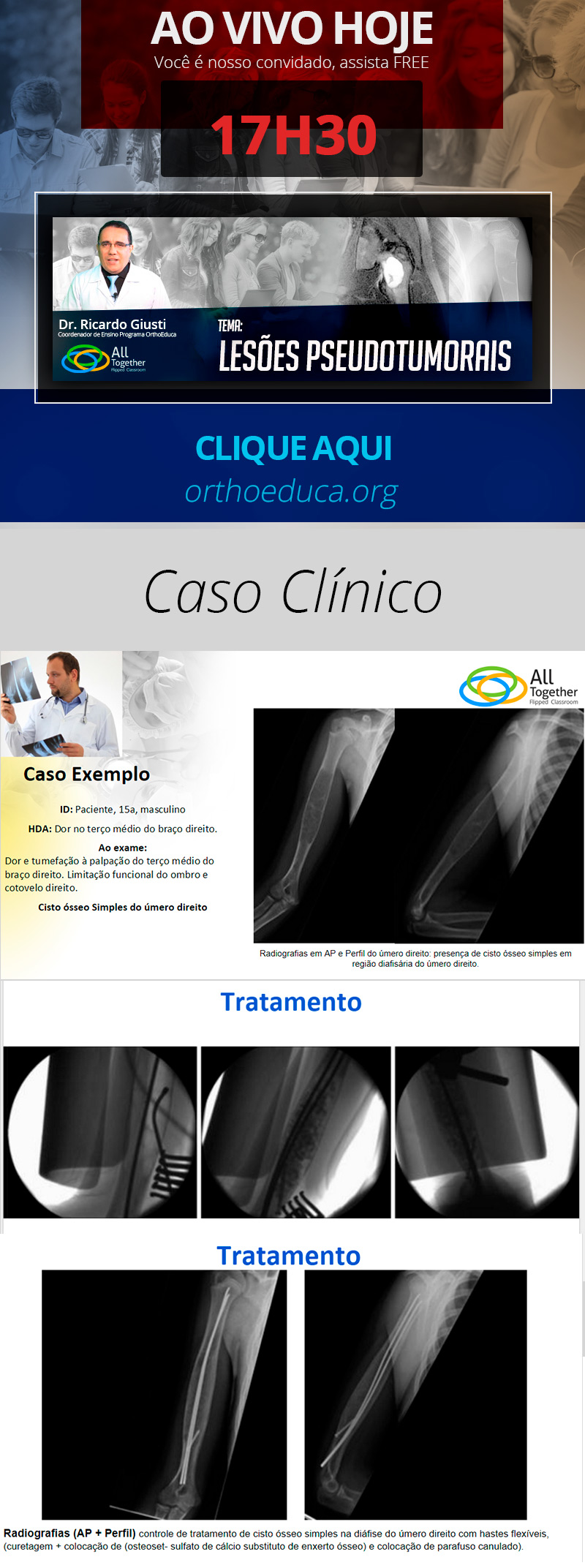 Lesões Pseudotumorais - Daqui a pouco as 17h30min - Assista FREE! Lesões Pseudotumorais - Daqui a pouco as 17h30min - Assista FREE!