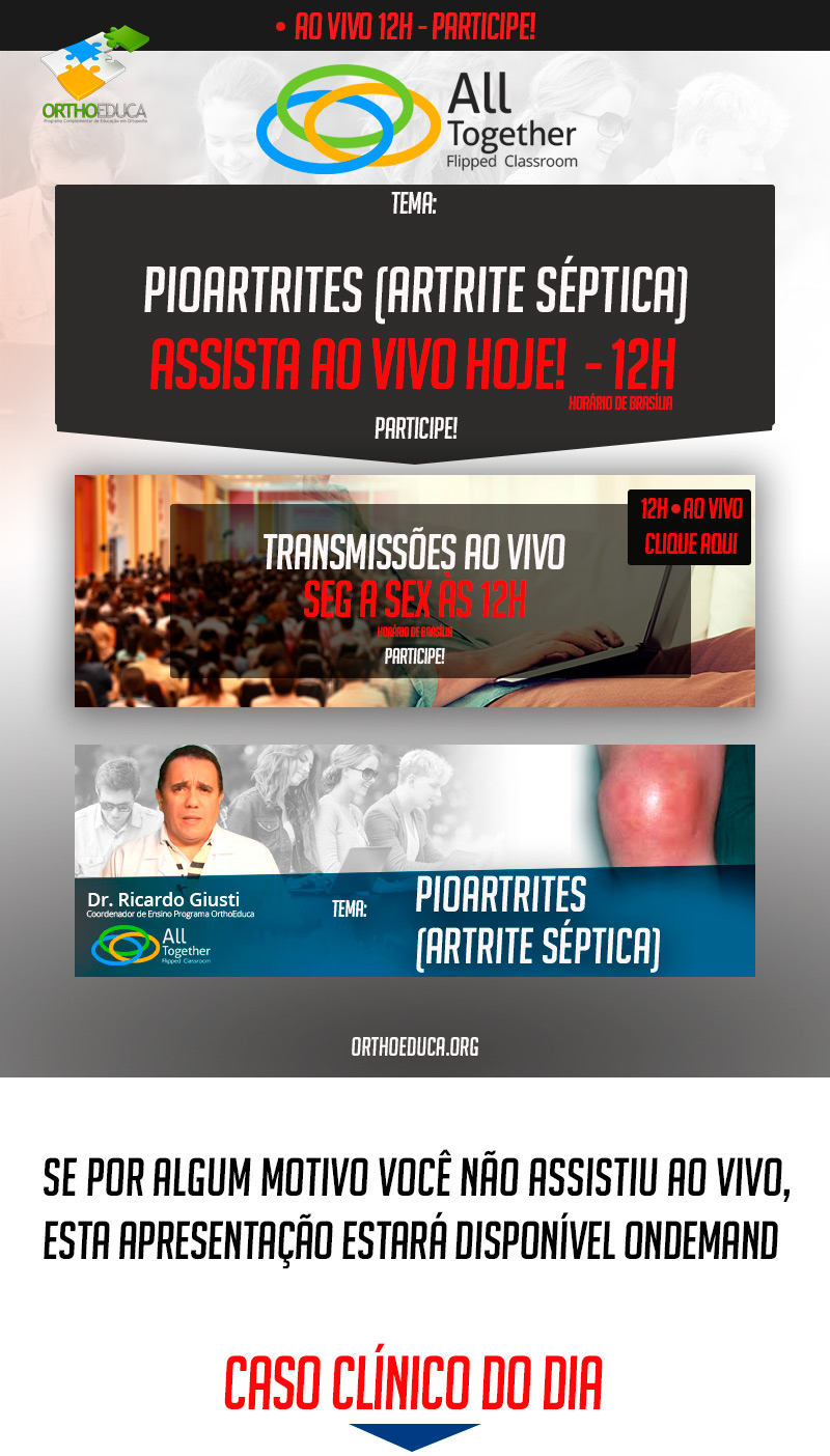 Pioartrites (Artrite Séptica) - Caso clínico de hoje no All Together às 12h Participe! Pioartrites (Artrite Séptica) - Caso clínico de hoje no All Together às 12h Participe!