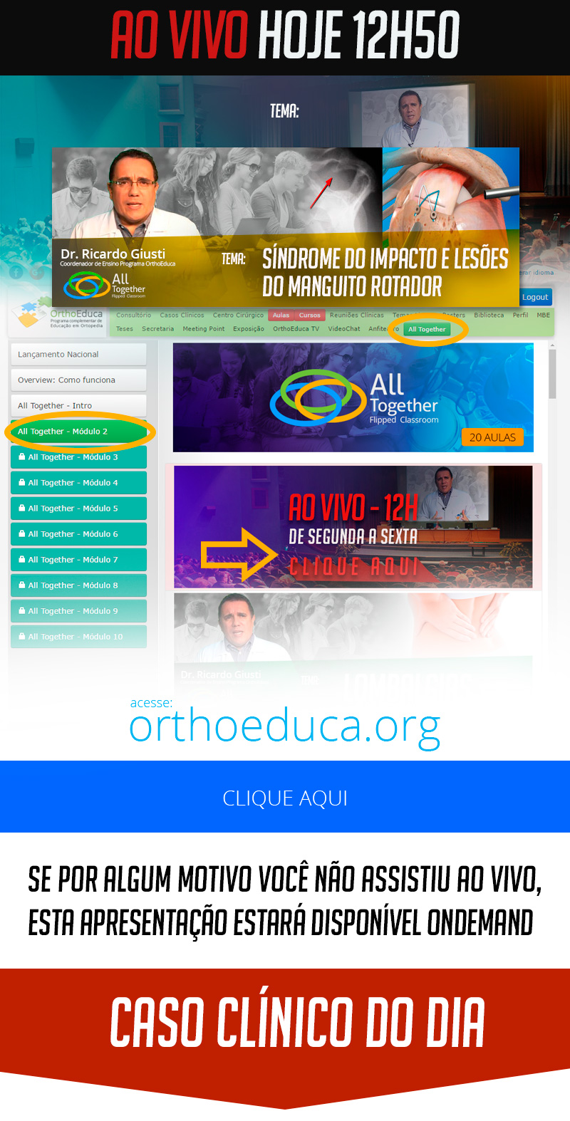 Síndrome do Impacto e Lesões do Manguito Rotador - Caso clínico de hoje no All Together às 12h50 Síndrome do Impacto e Lesões do Manguito Rotador - Caso clínico de hoje no All Together às 12h50